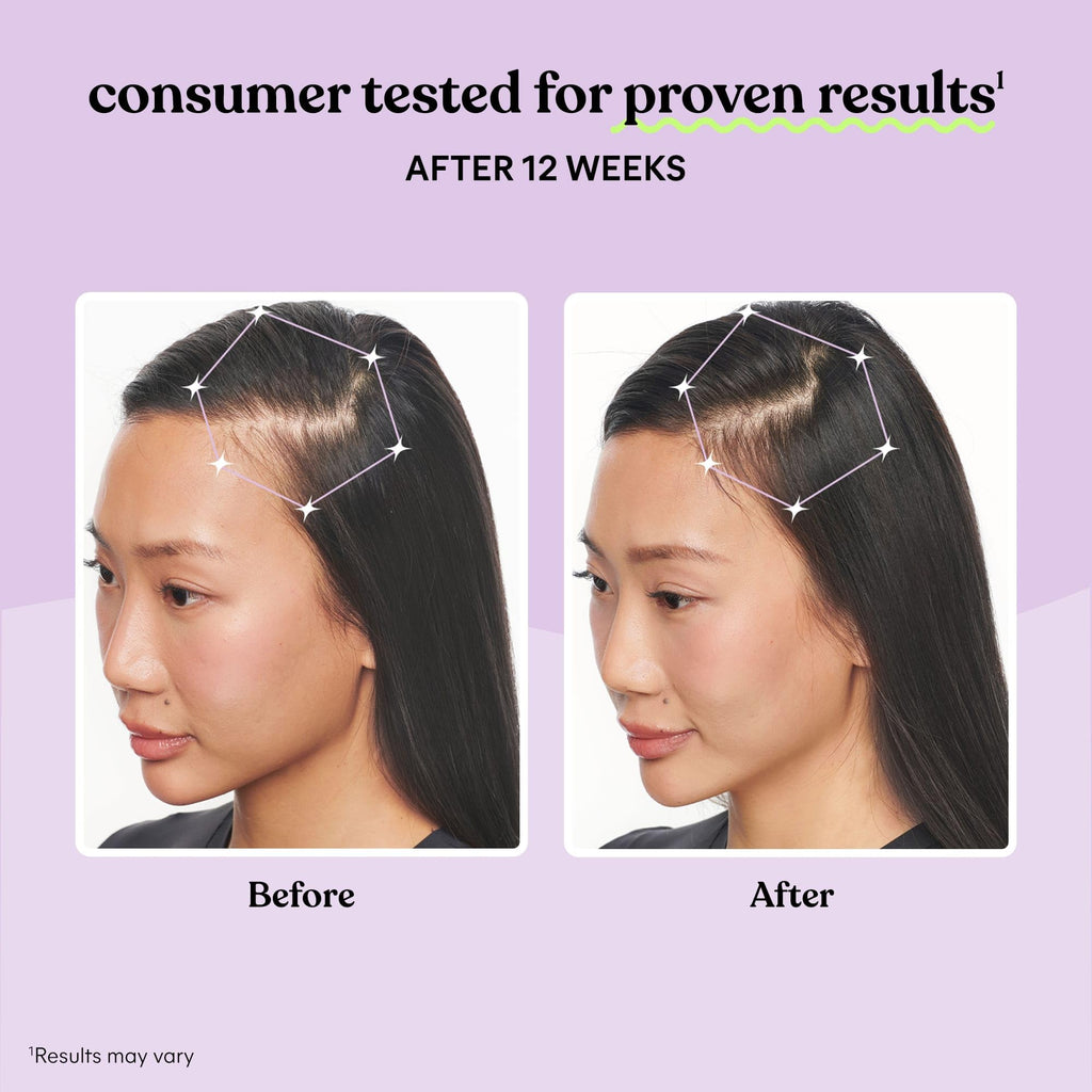 Hair Growth Capsules 30-Day Supply A285