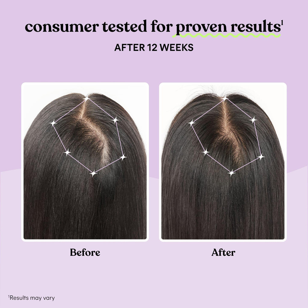 Hair Growth Capsules 30-Day Supply A285